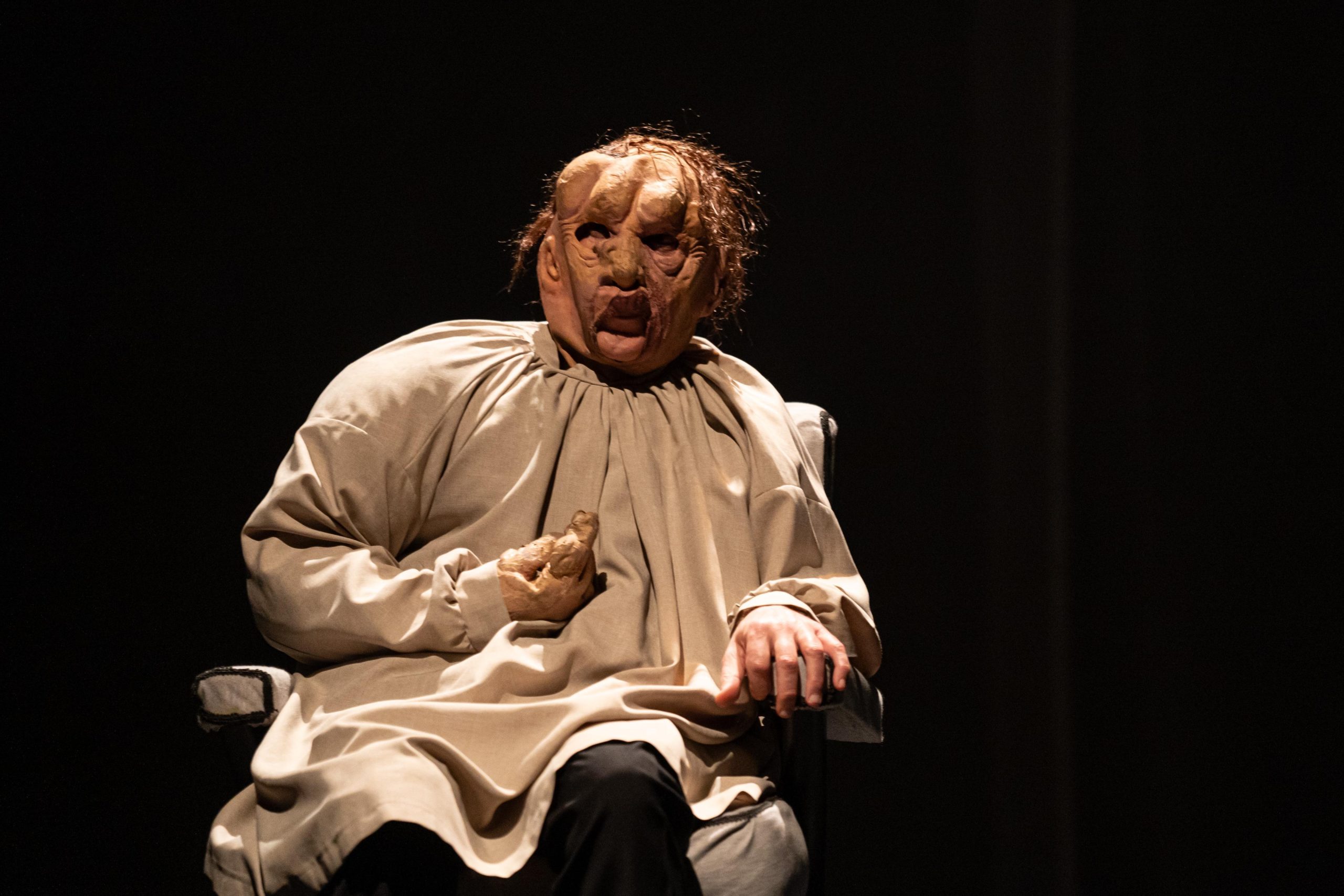 La puesta en escena “El Hombre Elefante”, que se basa en la historia real de Joseph Merrick